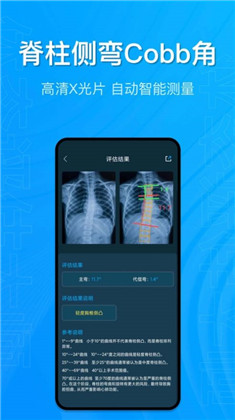 体态评估大师极速版下载-体态评估大师极速版 V1.0